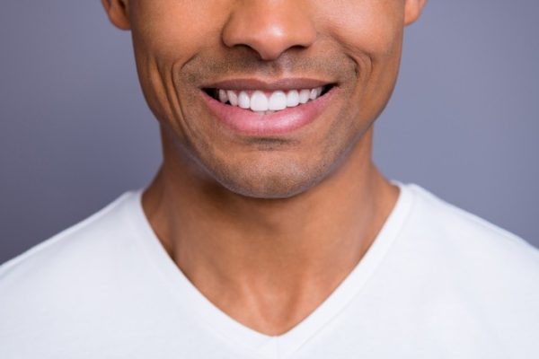 Dental Veneers, Confidence & the Smile Upgrade Everyone’s Talking About